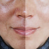 Radiance Restore: Redness & Dark Spot Solutions