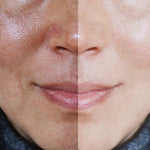 Radiance Restore: Redness & Dark Spot Solutions