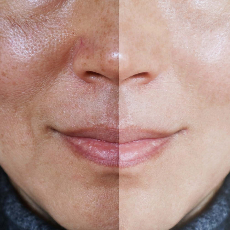 Radiance Restore: Redness & Dark Spot Solutions
